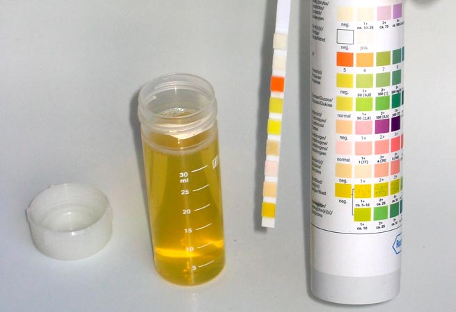 Image result for urin