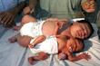 Svjetski rekorder: Najteža beba na svijetu imala je nevjerovatnih 10 kilograma
