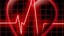 Studija o iznenadnoj srčanoj smrti