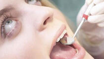 10 najgorih navika za zube