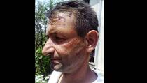Albanci brutalno pretukli dvojicu Bošnjaka bejzbol palicama