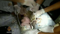 Spašeno novorođenče iz kanalizacijske cijevi