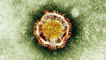 Novi virus prenosi se kontaktom, do sada umrlo više od 700 osoba