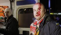 Desetine povrijeđenih u obračunu demonstranata s policijom