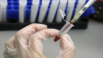 Jednostavnim testom krvi bit će moguće utvrditi 13 različitih vrsta raka