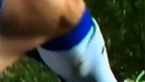 Evertonov nogometaš Bryan Oviedo slomio nogu