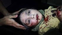 FOTO: Simbol sirijske djevojčice koji potresa svijet