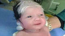 Mali Sirijac rođen sa sijedom kosom
