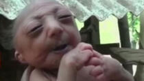 Rođena beba starac, majka odbila da je doji