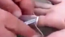 Doktor joj je htio rezati prst, zlatar prsten, a onda je došao inženjer (VIDEO)