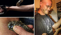 Amerikanac postao imun na zmijski otrov (VIDEO)