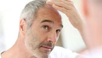 Kosa uopće ne sijedi zbog starenja – ovo su stvarni krivci! Ali, ima pomoći…