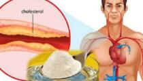 Najmoćniji antioksidant koji će očistiti vaše arterije od lošeg holesterola