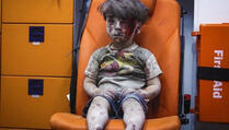 Ovako ranjeni dječak iz Sirije izgleda danas (FOTO/VIDEO)