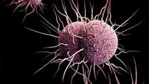 Stručnjaci strahuju: MG bi mogla postati sljedeća superbakterija