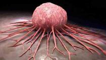 Čini čuda: Konzumacijom đumbira izliječila rak dojke (VIDEO)