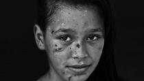 Dalia, nesalomljiva djevojčica iz Palestine