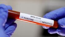 Na Kosovu 17 novozaraženih od koronavirusa, ukupno 780