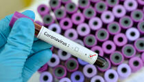 Vlada izdvojila 400.000 eura za mjere zaštite od koronavirusa