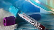Priština: Još tri pacijenta čeka rezultate testova na koronavirus