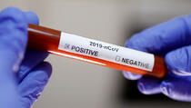 Zvaničnik ministarstva zdravlja pozitivan na koronavirus