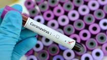 Potvrđeno još sedam novih slučajeva koronavirusa, na Kosovu oboljelo 86