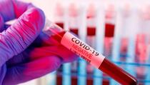 Potvrđena tri nova slučaja koronavirusa, ukupno 135