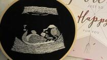 Slijepi budući tata dobio izvezenu fotografiju ultrazvuka da bi mogao "vidjeti" bebu