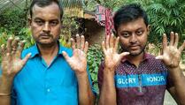U Bangladešu postoji porodica koja nema otiske prstiju, zbog toga imaju brojne probleme