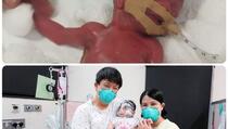 Najmanja beba na svijetu nakon 13 mjeseci napustila bolnicu