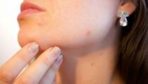 Navike koje negativno utječu na kožu