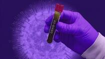 Naučnici zabrinuti: Otkriven koronavirus koji je prešao s psa na čovjeka
