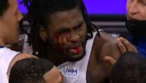 Haos na parketu: Stewart krvavog lica jurio košarkaša Lakersa