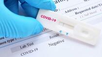Uhapšen muškarac zbog falsifikovanja testova za koronavirus