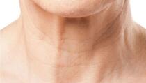 Bore na vratu nisu samo posljedica starenja: Kako ih prevenirati, ali i ublažiti?
