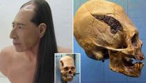 Ratniku iz Perue prije 2000 godina umetnut metalni implant u lobanju