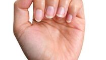 Izgled noktiju mogao bi biti pokazatelj bolesti srca, tvrde stručnjaci
