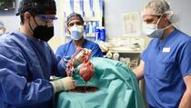 Preminuo prvi čovjek kojem je transplantirano genetski modificirano srce svinje