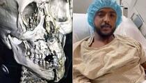 Uznemirujuće / Objavljen rendgenski snimak teško stradalog Saudijca, propustit će ostatak SP-a