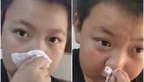 Dječak tvrdi da je alergičan na zadaću, video je postao hit