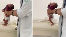 Snimka iznenadila ljude: Beba od samo nekoliko dana napravila prve korake