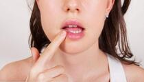 Šta uzrokuje pukotine u uglovima usana?