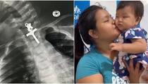 Šokantan snimak rentgena: U grlu djeteta "zapelo" raspelo