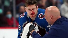 NHL zvijezdi nakon brutalnog starta slomljene sve kosti na licu