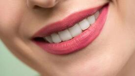 Zubi su vam žuti? Stomatolog otkriva 6 mogućih razloga