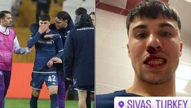 Navijač u Turskoj ušao na teren i nokautirao igrača Fiorentine nanijevši mu teške povrede