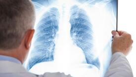 Nakon Kine i u Evropu stigao "sindrom bijelih pluća": Otporan je na penicilin, strahuje se od nove pandemije