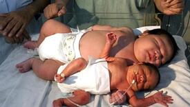 Svjetski rekorder: Najteža beba na svijetu imala je nevjerovatnih 10 kilograma