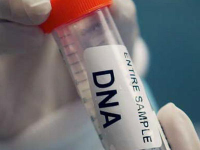 DNK testom