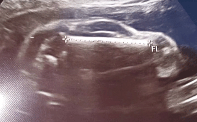 Vjerovatno najčudniji ultrazvuk koji smo vidjeli